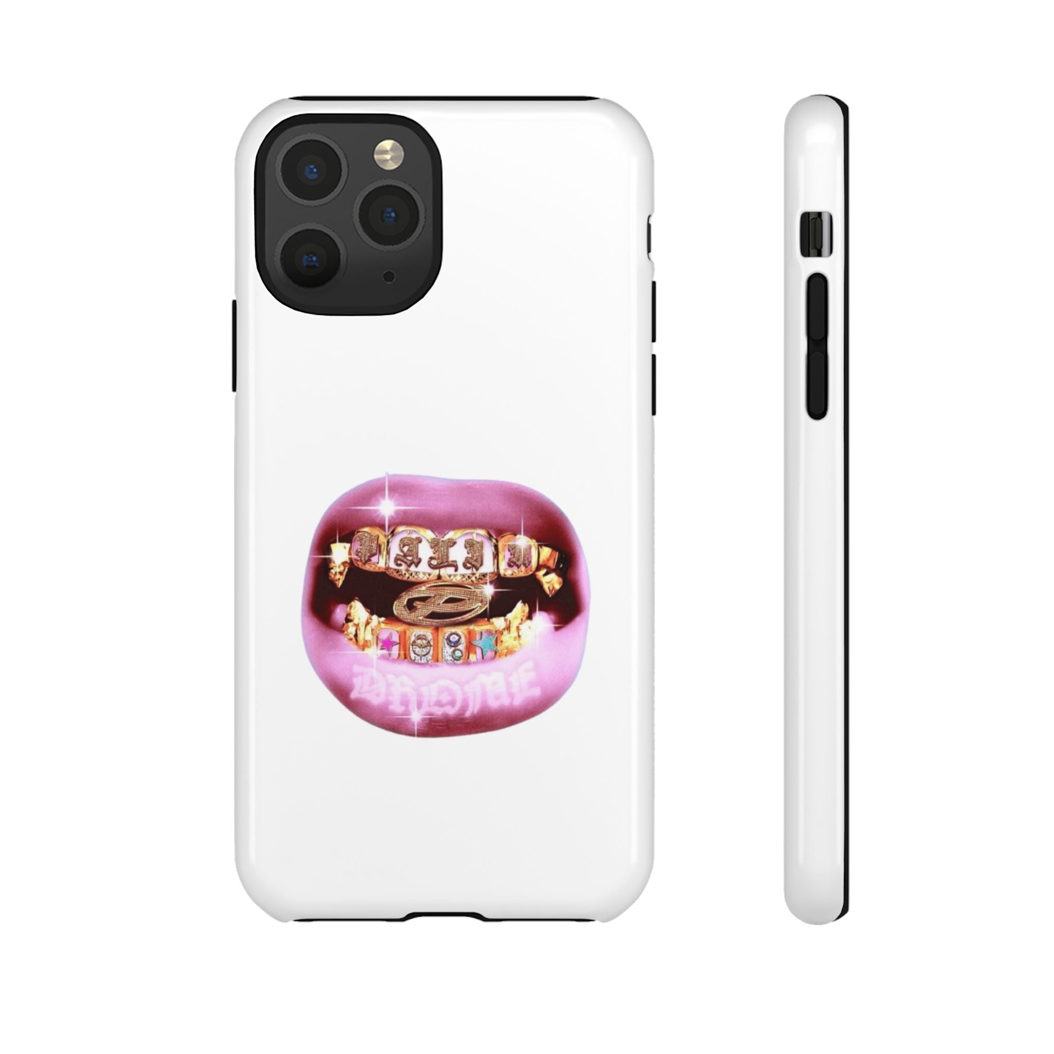 Pink Grillz Phone Case